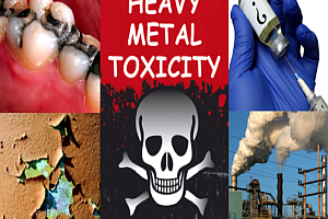 Heavy-Metal-Toxicity Heavy-Metal-Toxicity